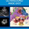 Endobronchial Ultrasound Made Easy (EPUB)