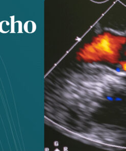 Harvard Boston 3D Echo Workshop 2025