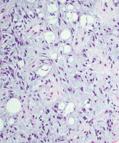 Oakstone Cleveland Clinic Comprehensive and Immersive Soft Tissue Pathology 2025