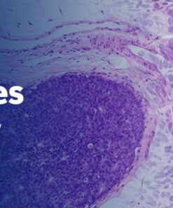 The Pathology of Neoplastic Diseases 2025 (Videos with subtitles + Slides)