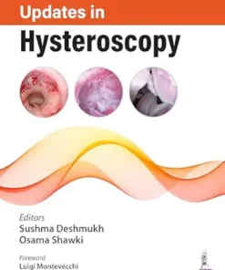 Updates in Hysteroscopy (PDF)