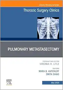 Pulmonary Metastasectomy, An Issue of Thoracic Surgery Clinics (Volume 35-2) (The Clinics: Internal Medicine, Volume 35-2) (True PDF)