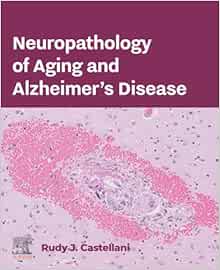 Neuropathology of Aging and Alzheimer’s Disease (True PDF from Publisher)