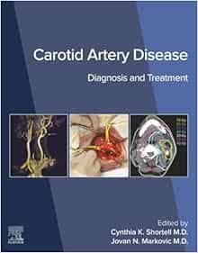 Carotid Artery Disease: Diagnosis and Treatment (True PDF)