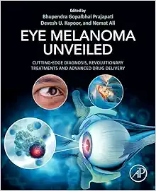 Eye Melanoma Unveiled: Cutting-Edge Diagnosis, Revolutionary Treatments and Advanced Drug Delivery (True PDF)