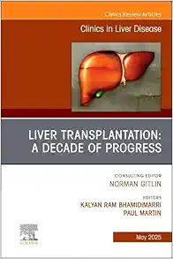 Liver Transplantation: A Decade of Progress, An Issue of Clinics in Liver Disease (Volume 29-2) (The Clinics: Internal Medicine, Volume 29-2) (True PDF from Publisher)