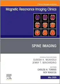 Spine Imaging, An Issue of Magnetic Resonance Imaging Clinics of North America (Volume 33-2) (The Clinics: Radiology, Volume 33-2) (True PDF)