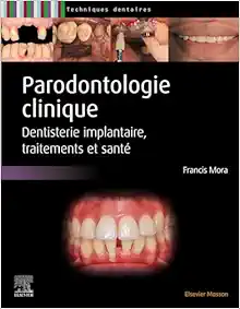 Parodontologie clinique: Dentisterie implantaire, traitements et santé (French Edition) (True PDF from Publisher)