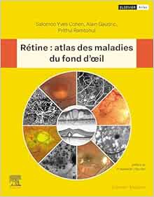 Rétine : atlas des maladies du fond d’oeil (French Edition) (True PDF)