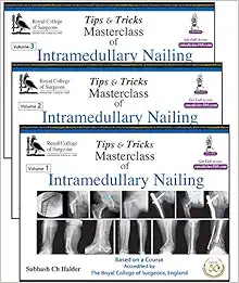 Tips & Tricks Masterclass of Intramedullary Nailing, 3 Volumes Set (PDF)
