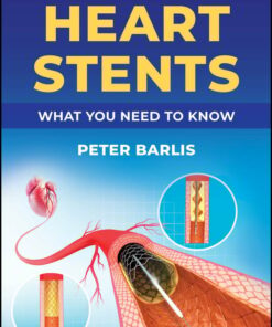 Heart Stents (PDF)