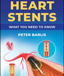 Heart Stents (EPUB)