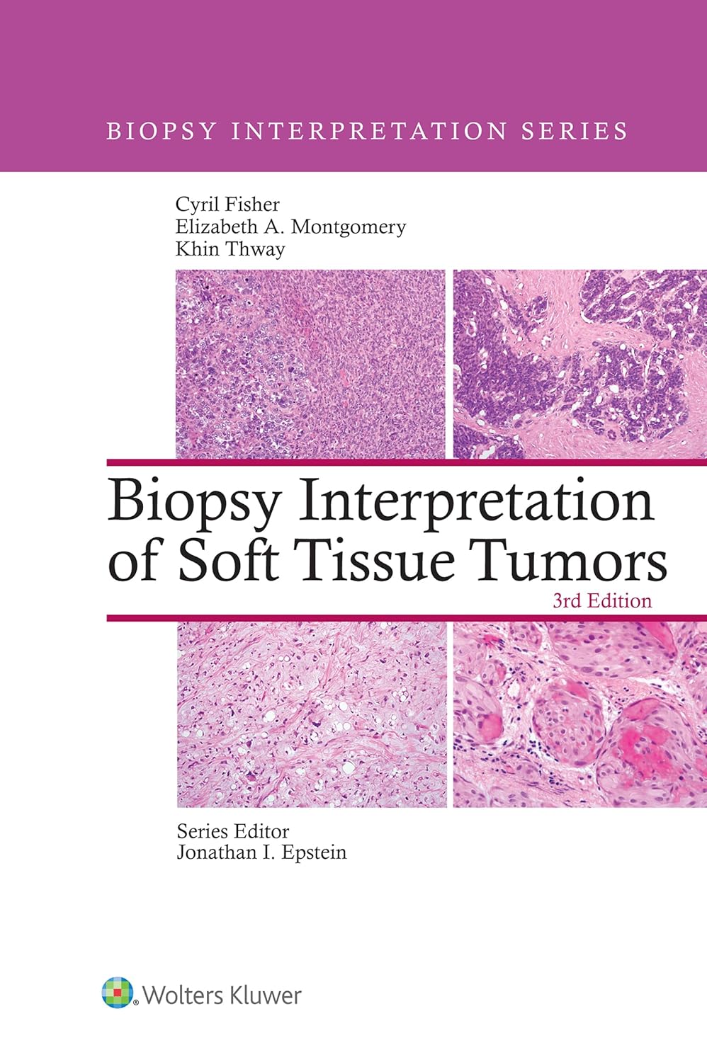 Biopsy Interpretation of Soft Tissue Tumors, 3rd Edition (EPUB) Biopsy Interpretation of Soft Tissue Tumors, 3rd Edition (EPUB)