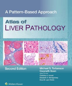Atlas of Liver Pathology: A Pattern-Based Approach, 2nd Edition (EPUB)