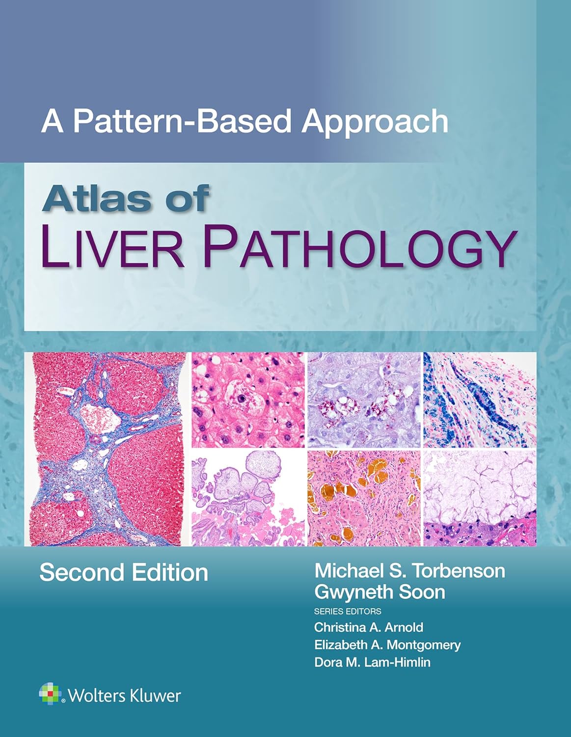 Atlas of Liver Pathology: A Pattern-Based Approach, 2nd Edition (EPUB) Atlas of Liver Pathology: A Pattern-Based Approach, 2nd Edition (EPUB)