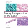 Biopsy Interpretation of the Lung (Biopsy Interpretation Series) (EPUB)