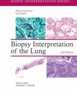 Biopsy Interpretation of the Lung (Biopsy Interpretation Series) (EPUB)