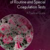 Interpretation of Results of Routine and Special Coagulation Tests: A Practical Guide (PDF)