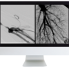 Echo Whistler: Frontiers of Multimodality Imaging Including Echo, Cardiac CT and MRI (Videos + Slides) Echo Whistler: Frontiers of Multimodality Imaging Including Echo, Cardiac CT and MRI (Videos + Slides)
