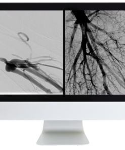 Echo Whistler: Frontiers of Multimodality Imaging Including Echo, Cardiac CT and MRI (Videos + Slides)