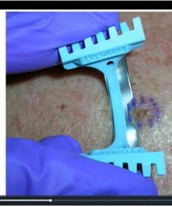 Primary Care On Demand: Dermatology, Volume 2 (Videos + Slides)