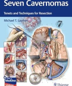 Seven Cavernomas: Tenets and Techniques for Resection (Original PDF)