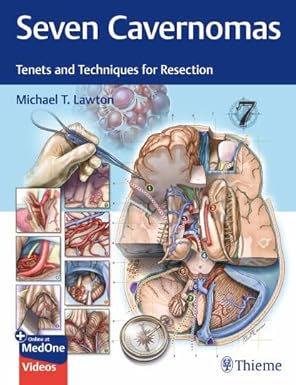 Seven Cavernomas: Tenets and Techniques for Resection (Original PDF) Seven Cavernomas: Tenets and Techniques for Resection (Original PDF)