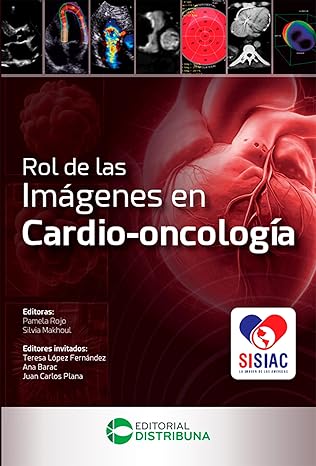 Rol de las imágenes en cardio-oncología (Spanish Edition) (EPUB) Rol de las imágenes en cardio-oncología (Spanish Edition) (EPUB)