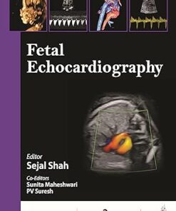 Fetal Echocardiography, 2nd edition (PDF)