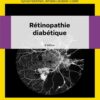 Rétinopathie diabétique, 3rd Edition (EPUB)