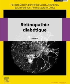 Rétinopathie diabétique, 3rd Edition (EPUB)