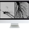American Roentgen Ray Society Case Review of Vascular and Interventional Radiology 2023 American Roentgen Ray Society Case Review of Vascular and Interventional Radiology 2023