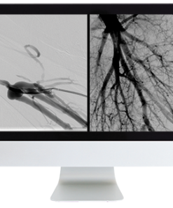 American Roentgen Ray Society Case Review of Vascular and Interventional Radiology 2023