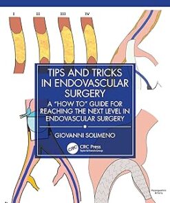 Tips and Tricks in Endovascular Surgery: A “How to” Guide for reaching the next Level in Endovascular Surgery (PDF)