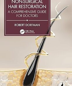 Non-Surgical Hair Restoration: A Comprehensive Guide for Doctors (PDF)