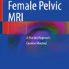 Female Pelvic MRI A Practical Approach (PDF)