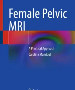 Female Pelvic MRI A Practical Approach (PDF)