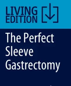 The Perfect Sleeve Gastrectomy A Clinical Guide to Evaluation, Treatment, and Techniques (PDF)