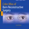 Color Atlas of Burn Reconstructive Surgery (PDF)