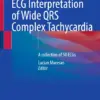 ECG Interpretation of Wide QRS Complex Tachycardia A collection of 50 ECGs (PDF)