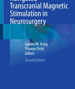 Navigated Transcranial Magnetic Stimulation in Neurosurgery (PDF)
