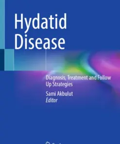 Hydatid Disease Diagnosis, Treatment and Follow Up Strategies (PDF)