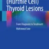 Oncocytic (Hürthle Cell) Thyroid Lesions From Diagnosis to Treatment (PDF)