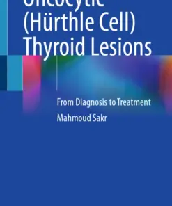 Oncocytic (Hürthle Cell) Thyroid Lesions From Diagnosis to Treatment (PDF)