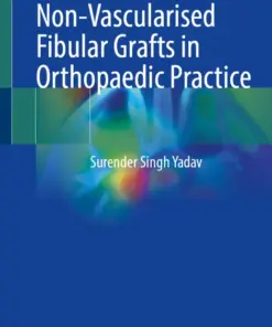 Non-Vascularised Fibular Grafts in Orthopaedic Practice (PDF)