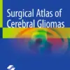 Surgical Atlas of Cerebral Gliomas (PDF)