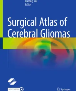 Surgical Atlas of Cerebral Gliomas (PDF)