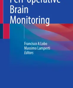 Peri-operative Brain Monitoring (PDF)