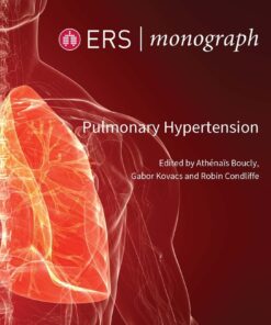 Pulmonary Hypertension (ERS Monograph 109) (EPUB)