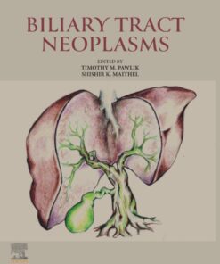 Biliary Tract Neoplasms (True PDF)